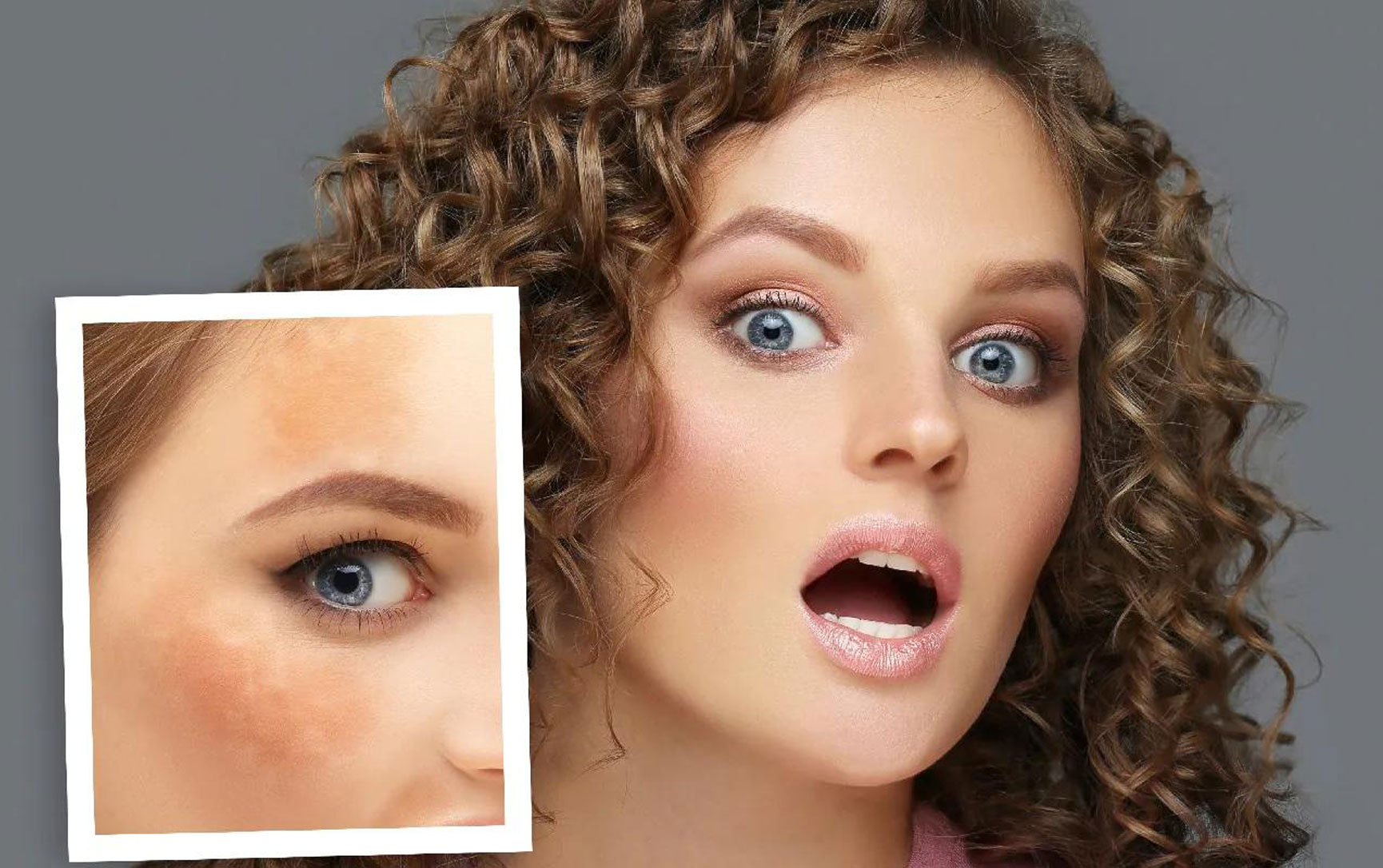 Winter can make hyperpigmentation worse. Try these tips to manage it